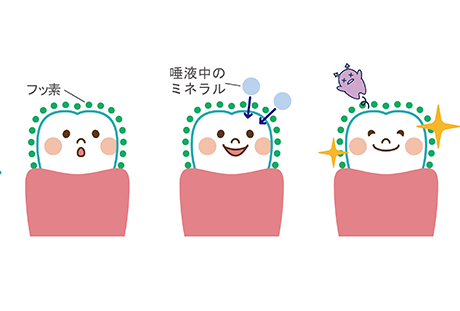 フッ素塗布